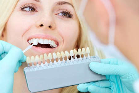 dentiste et choix couronne dentaire