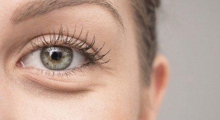paupiere lourde