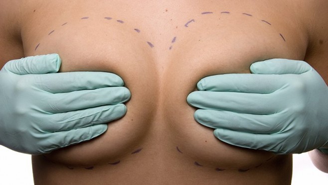 Chirurgie esthétique des seins : comment ça marche ? (et les risques)